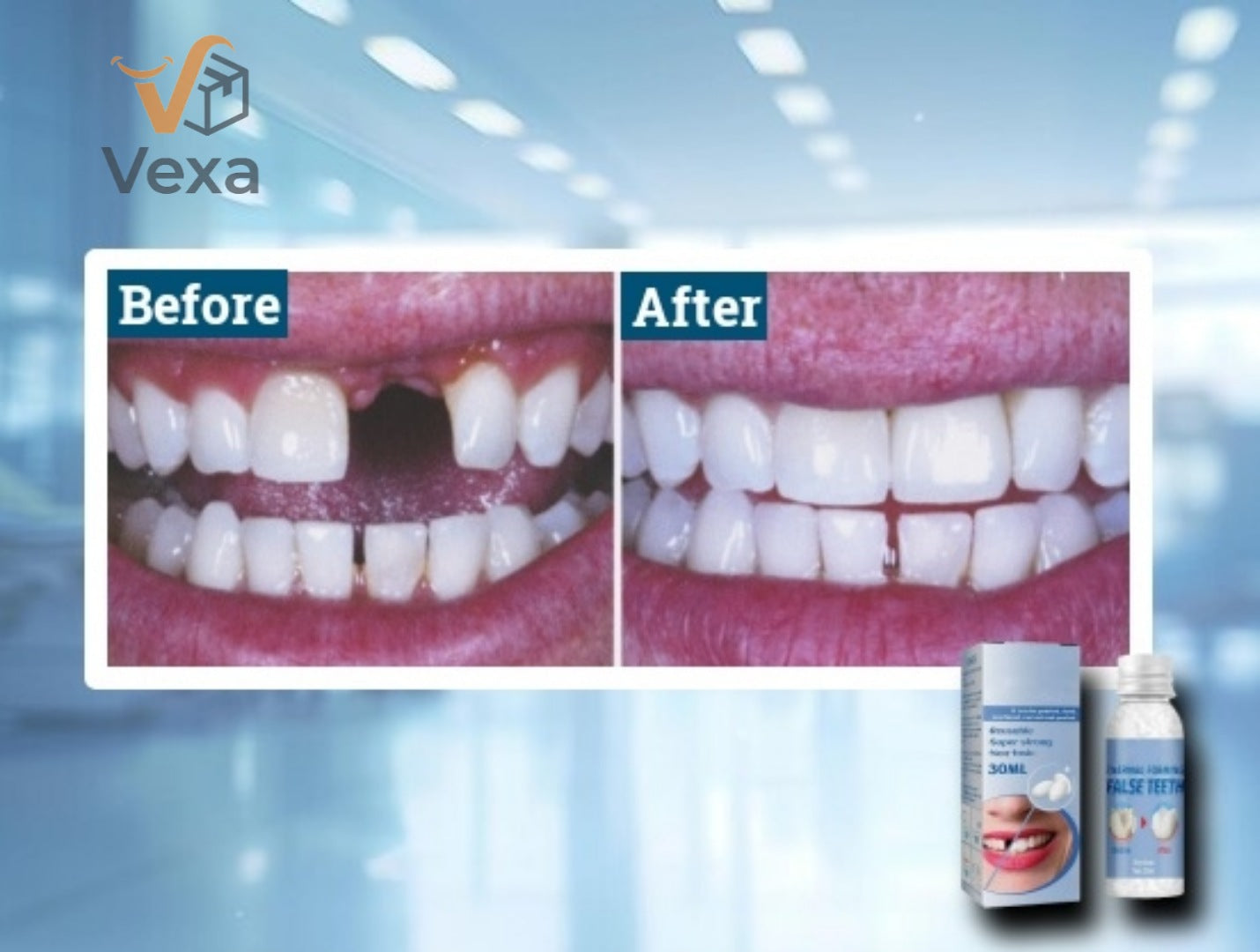 VexaSmile™ - Professional DIY Tooth Repair Kit