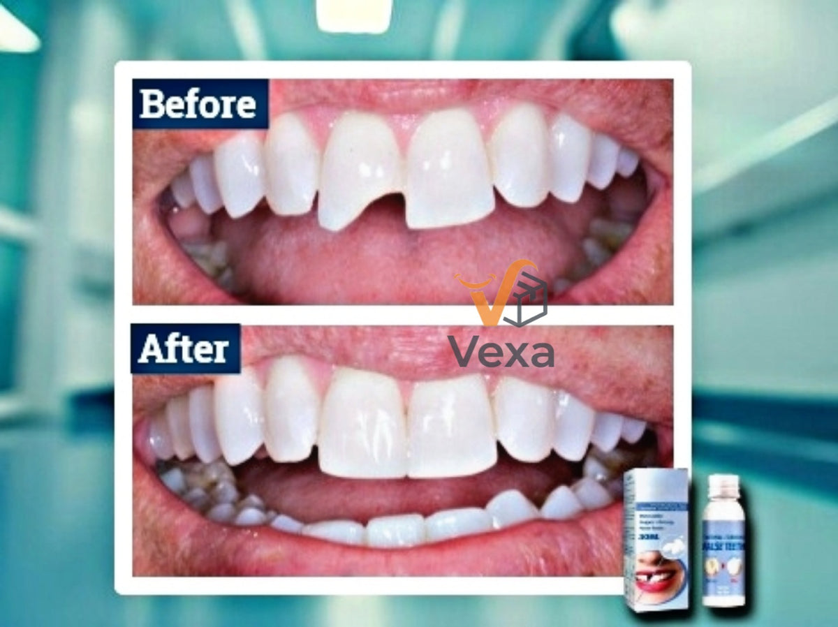 VexaSmile™ - Professional DIY Tooth Repair Kit